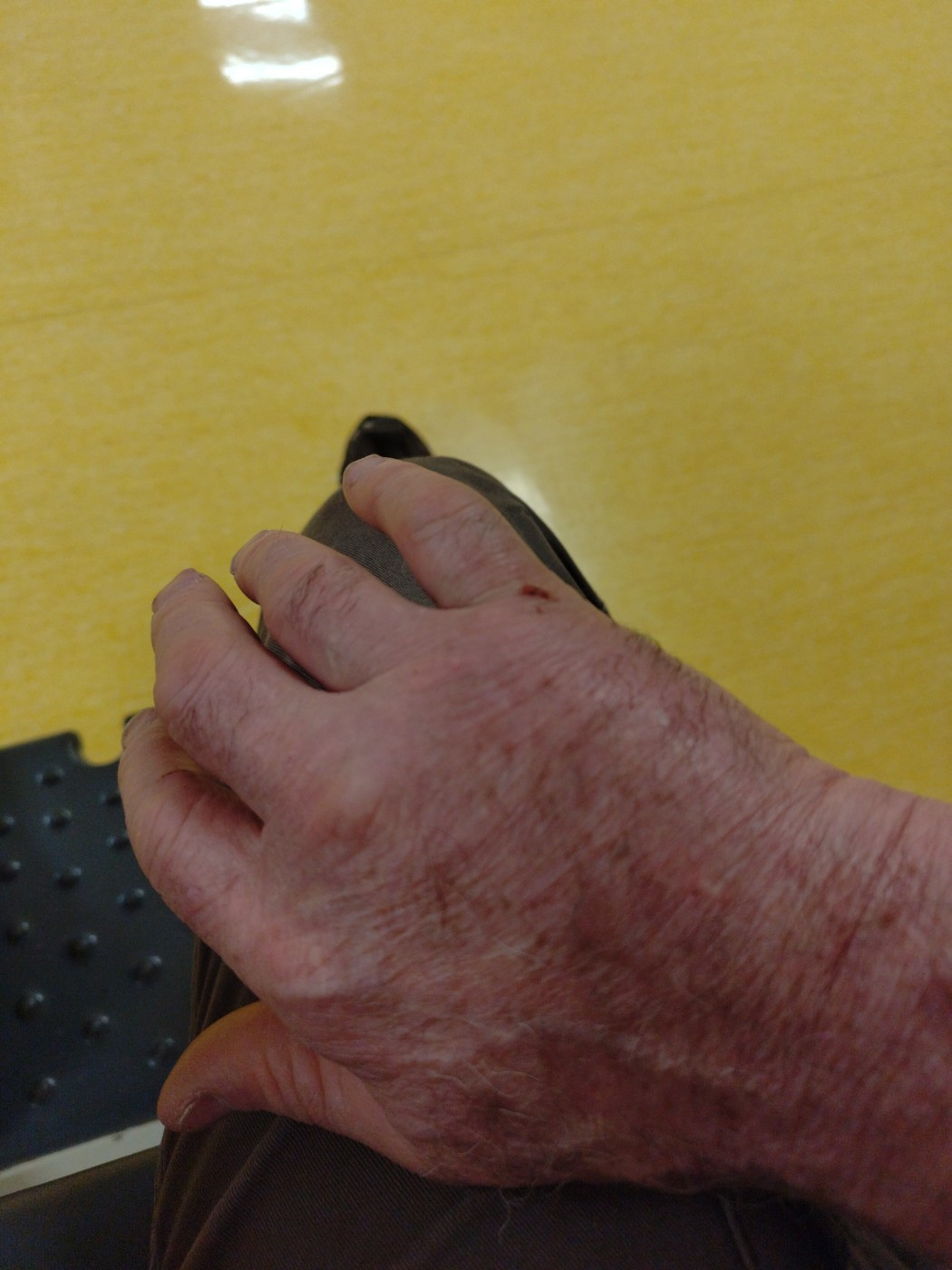 De la dent dure - On est tous esquintes ...